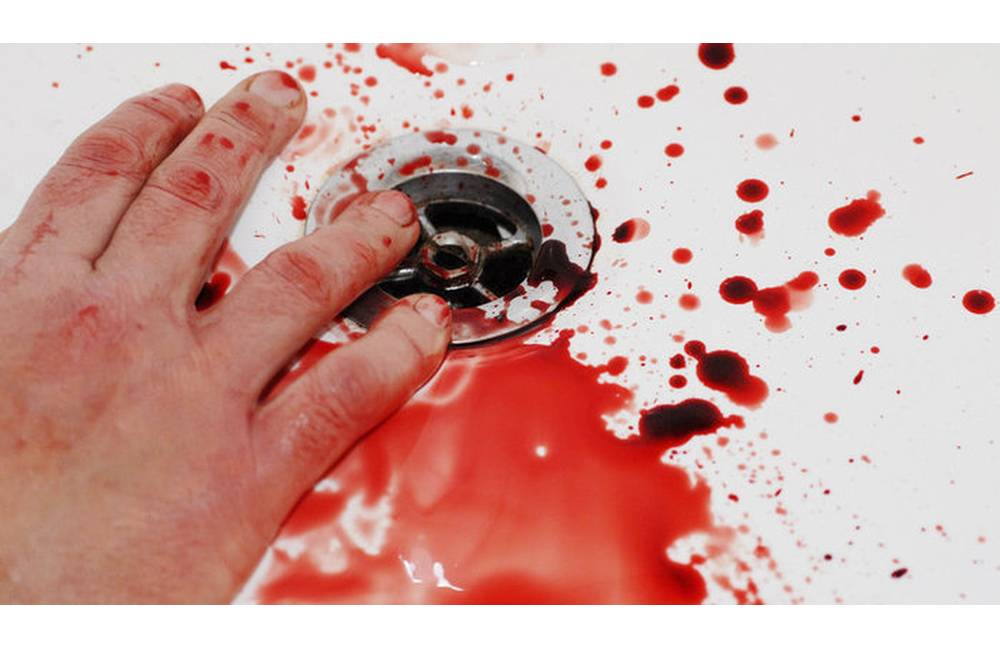 Foto: V Budatíne našli v dome ležať muža v kaluži krvi