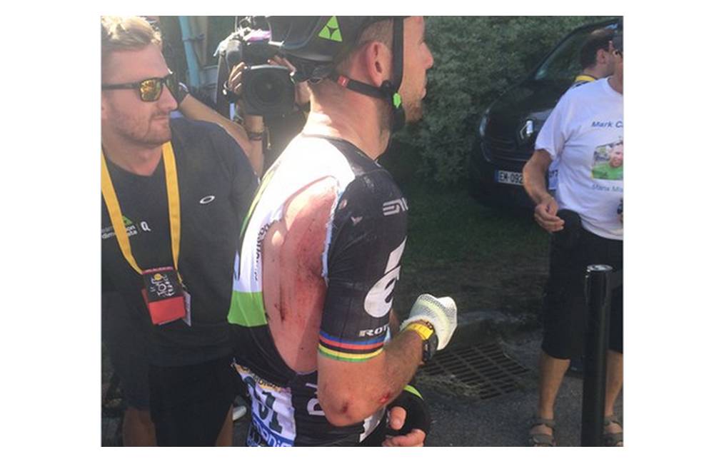 Foto: Sagan sa ospravedlnil Cavendishovi, ten má po páde obviazanú ruku