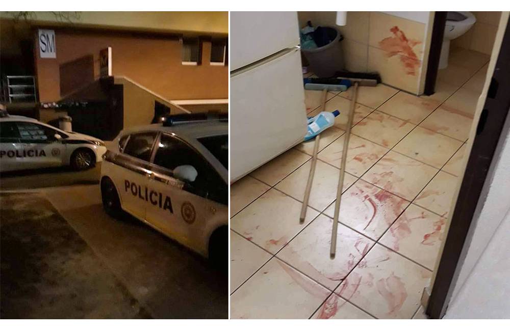Na vysokoškolských internátoch v Žiline sa v noci strieľalo, 19-ročného mladíka ošetrili v nemocnici