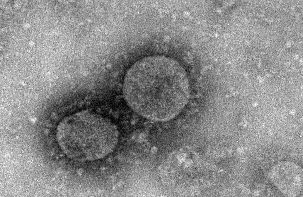 Výsledky testov na koronavírus očakávajú do dvoch dní, ministerstvo zriadilo infolinku