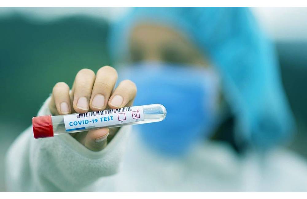 V stredu pribudlo 121 pacientov s ochorením COVID-19, v Žilinskom kraji evidujú 16 osôb