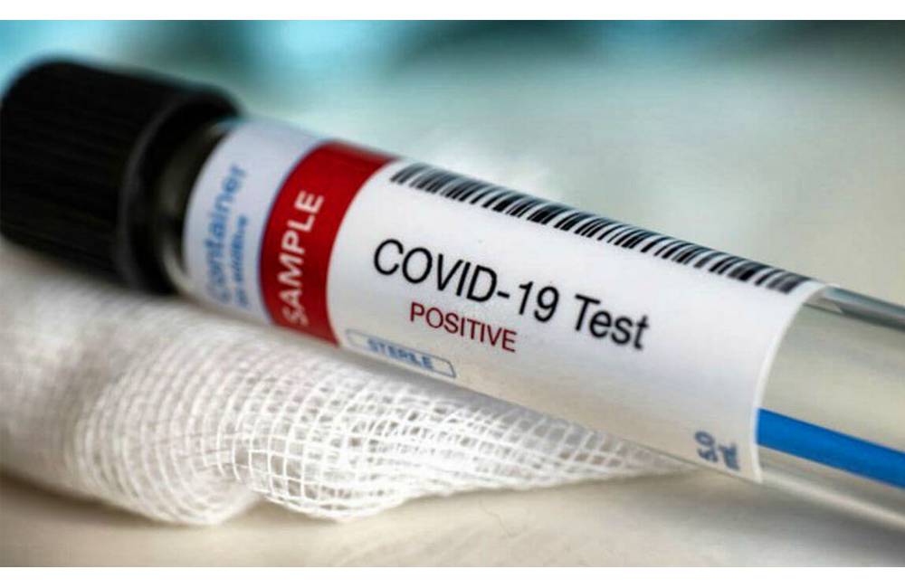Vo štvrtok pribudlo 137 prípadov koronavírusu, v Žilinskom kraji evidujú 18 nových pacientov