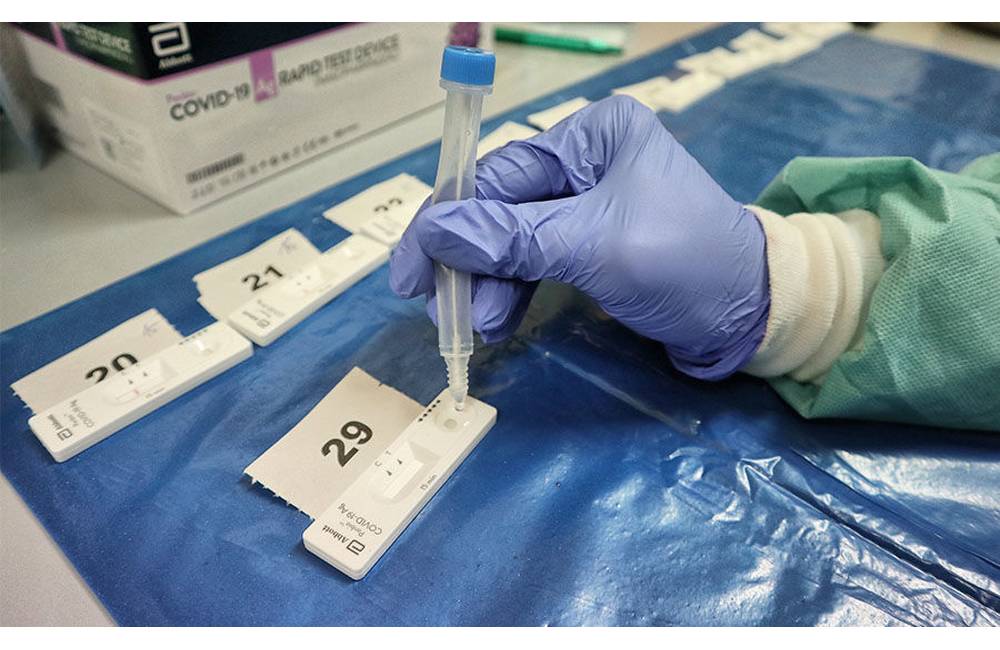 Vyše štvrtina pozitívnych PCR testov za včera je zo Žilinského kraja, opäť prevládajú nezaočkovaní
