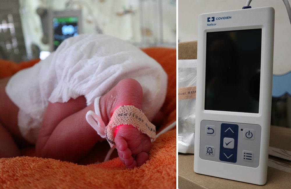 Žilinská nemocnica zakúpila vďaka finančnému daru najnovší pulzný oxymeter pre novorodencov