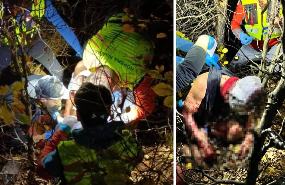 Medveď napadol 38-ročného bežca v Malej Fatre, pohrýzol mu celé telo a zaútočil aj na tvár