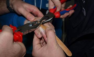 V Čadci privolali hasičov do nemocnice na pomoc pri odstránení prsteňa