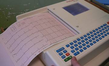 Chirurgické oddelenie žilinskej nemocnice dostalo od firmy Doprastav nový EKG prístroj