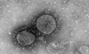 Výsledky testov na koronavírus očakávajú do dvoch dní, ministerstvo zriadilo infolinku