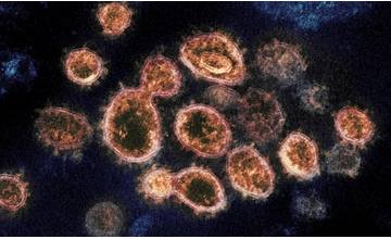 AKTUÁLNE: Prvá nákaza koronavírusom v Žilinskom kraji, od zajtra platí zákaz podujatí
