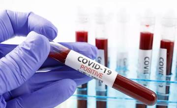 V okrese Žilina pribudlo v piatok 8 nových prípadov ochorenia COVID-19