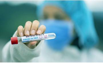 V stredu pribudlo 121 pacientov s ochorením COVID-19, v Žilinskom kraji evidujú 16 osôb