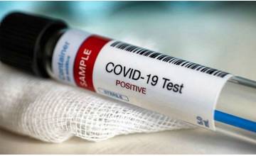 V piatok pribudlo 290 prípadov koronavírusu, najviac nakazených v Žilinskom kraji je na Orave