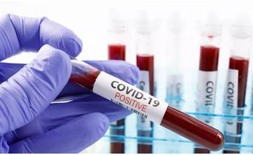 V stredu pribudlo 360 prípadov koronavírusu, najviac v rámci kraja evidujú na Orave a Liptove