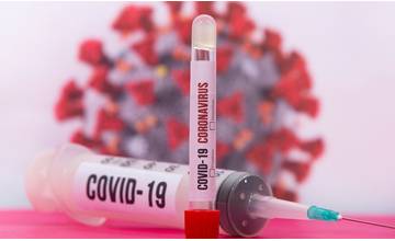 V nedeľu pribudlo 265 nových prípadov koronavírusu, viac než osemdesiat evidujú na Orave