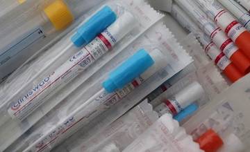 Sobotňajšie testovanie odhalilo v okrese Žilina až 240 nových prípadov koronavírusu