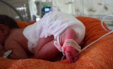 Pôrodnicu vo Fakultnej nemocnici s poliklinikou v Žiline si vyberá najviac mamičiek v kraji