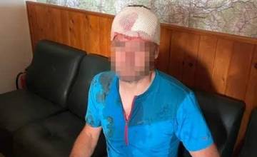 Horského záchranára vo Veľkej Fatre napadol medveď, muž utrpel tržnú ranu na hlave