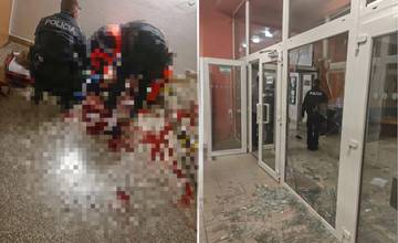 Agresívny študent po plese žilinskej univerzity rozbil dvere internátov a vážne si poranil nohu