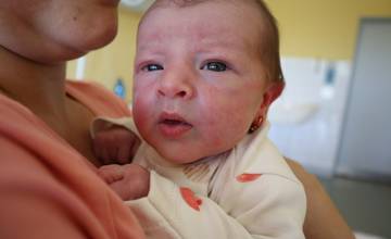 V septembri sa v žilinskej nemocnici narodilo 125 detí. Na svet prišli aj dva páry dvojičiek