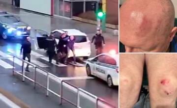 Drsný policajný zásah v Žiline rovno pred očami 3-ročného dieťaťa. Dôvodom bolo oškreté auto