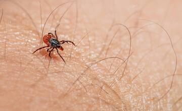 Pozor na kliešte, môžu spôsobiť vážne zdravotné komplikácie. Ako sa pred nimi chrániť?