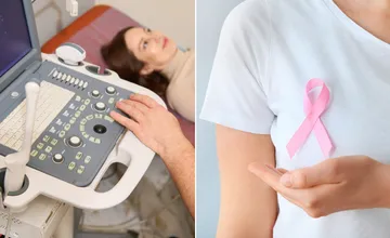 Sonografické vyšetrenia prsníkov pre mladé ženy sa rušia, mamografia však zostáva kľúčová