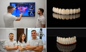 ALL-ON-4: Revolučná fixná náhrada zubov pre bezzubú čeľusť