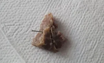 Ružomberok varuje psíčkarov: V tejto lokalite sa objavili kúsky mäsa s klincami