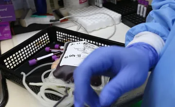 Nemocnica na Liptove prosí o pomoc: Míňajú sa zásoby krvi pre pacientov