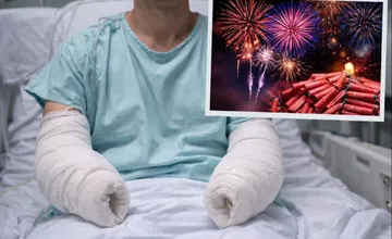 Silvestrová noc sa zmenila na tragédiu, mužovi u našich susedov zakázaná pyrotechnika odpálila obe ruky