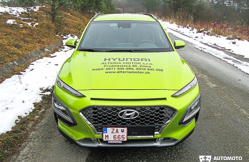 Redakčný test Hyundai Kona, foto 3