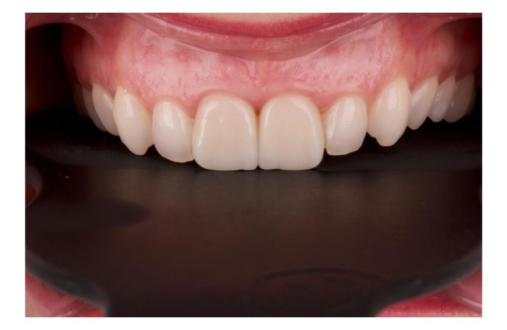 FOTO: Prioritou zubnej ambulancie Dental Atelier je kvalita výkonu, foto 18