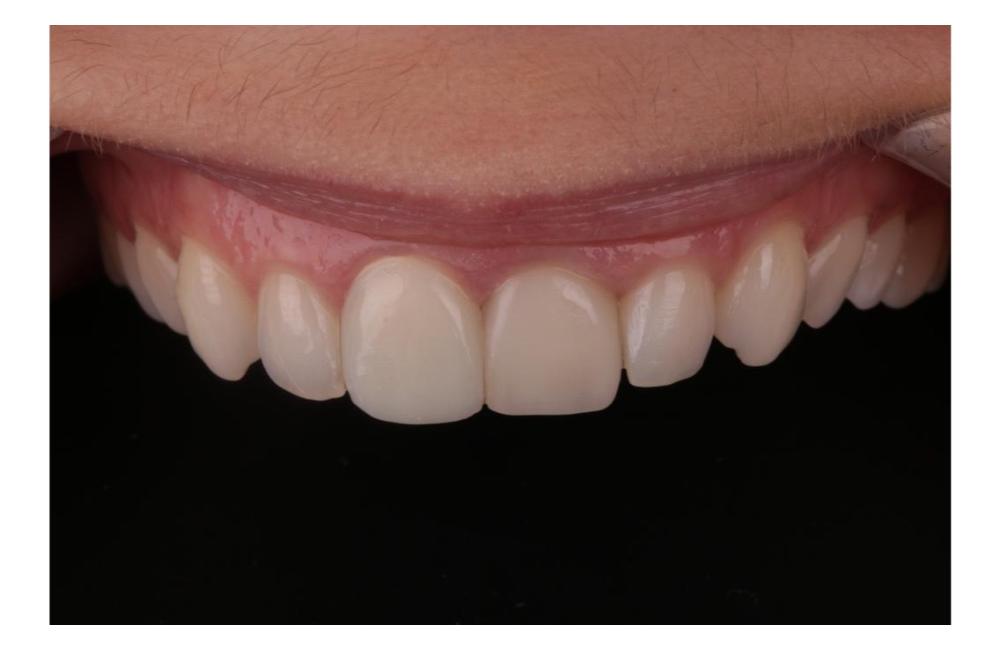 FOTO: Prioritou zubnej ambulancie Dental Atelier je kvalita výkonu, foto 19