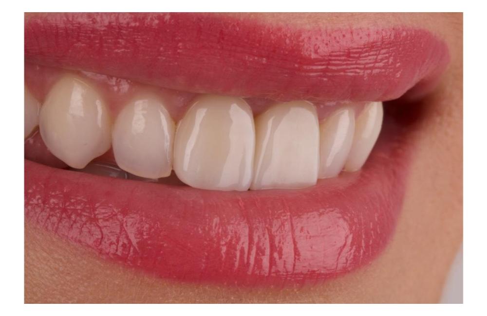 FOTO: Prioritou zubnej ambulancie Dental Atelier je kvalita výkonu, foto 20