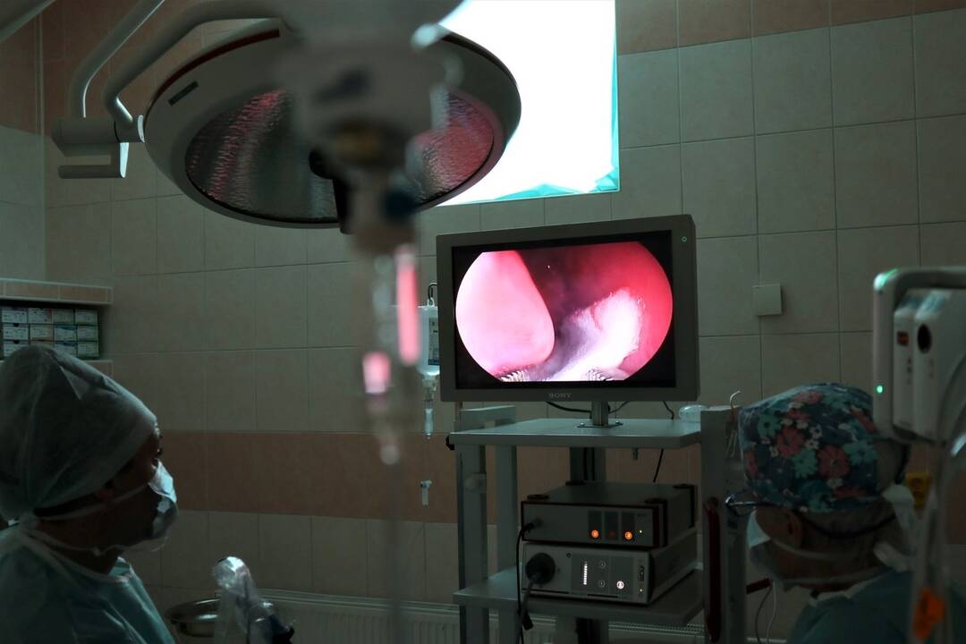FOTO: V žilinskej nemocnici operovali zriedkavý nádor, foto 2